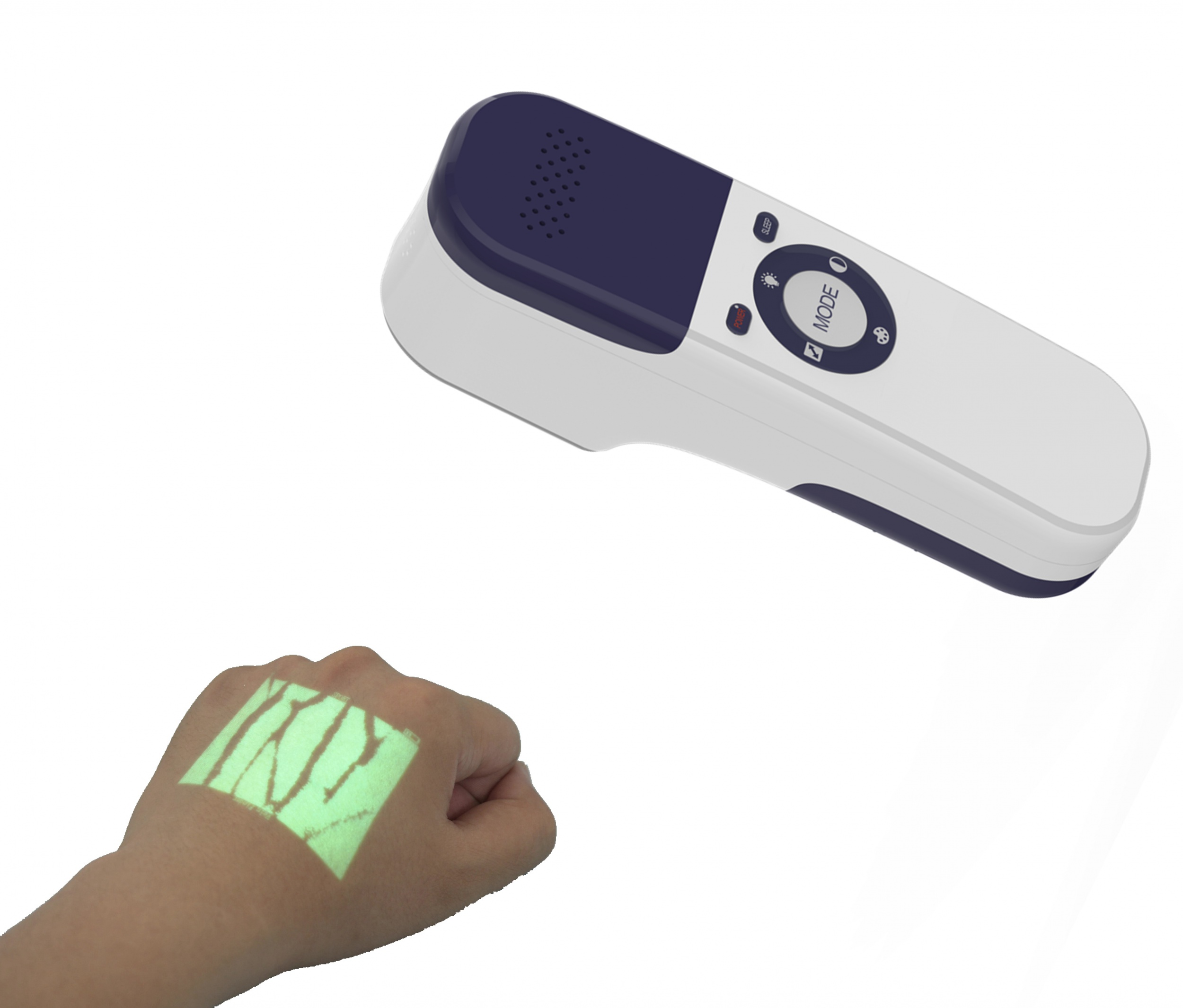 PORTABLE VEIN VIEWER (FINDER)