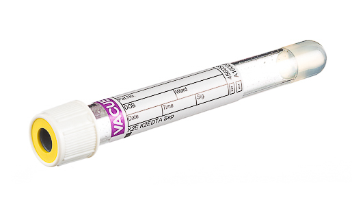 Vacuette EDTA Tube K2E Separator, non-ridged cap, paper label, 5 ml
