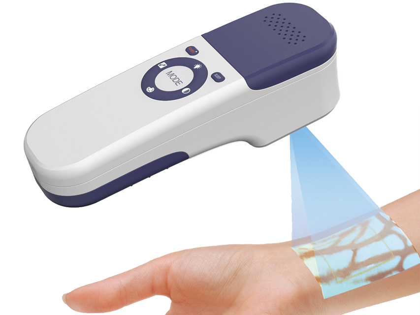 Portable Vein Viewer