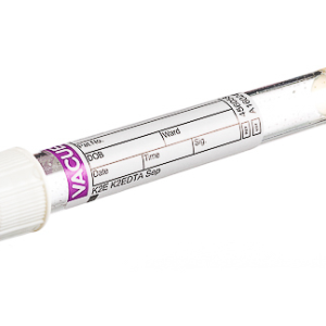 Vacuette EDTA Tube K2E Separator, non-ridged cap, paper label, 5 ml